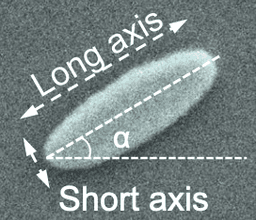 Long axis Short axis